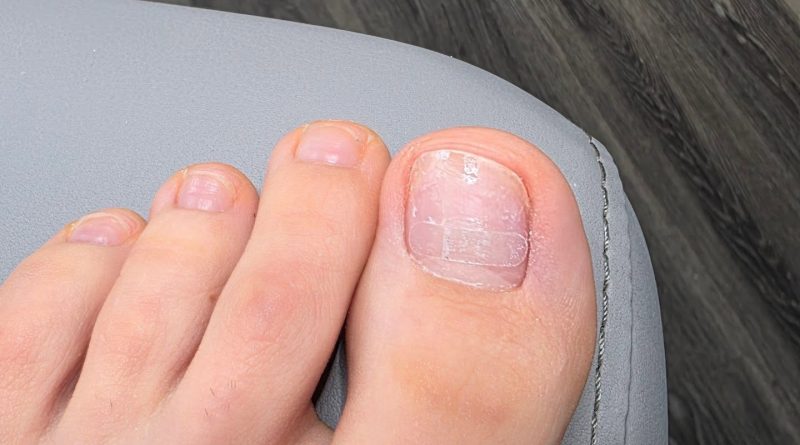 Может ли коррекция ногтей быть невидимой, да)